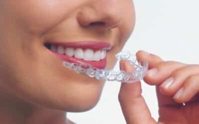 A Comprehensive Guide To Invisalign Treatment