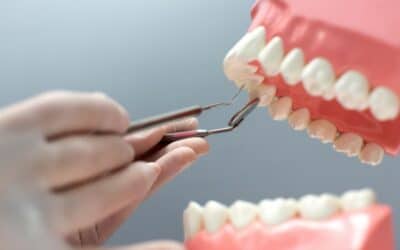 Know The Different Types Of Dental Bridges