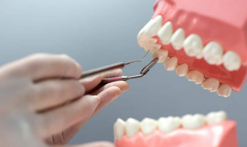 Know The Different Types Of Dental Bridges