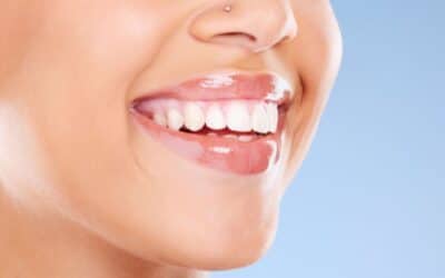 Unlock Confidence With Cosmetic Dental Procedures in Stillwater