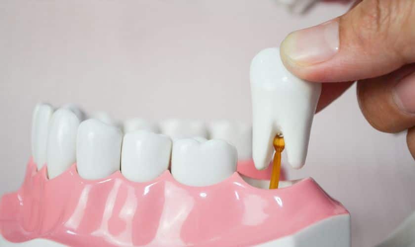The Ultimate Guide To Preparing For Tooth Extraction