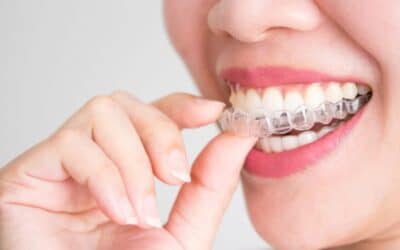 How Does Invisalign Move Your Teeth