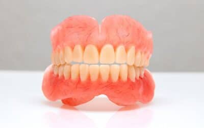 Why Should You Choose Dentures For Your Mouth?