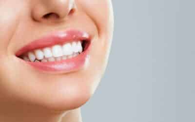 What is The Safest Way to Whiten Teeth in Stillwater?