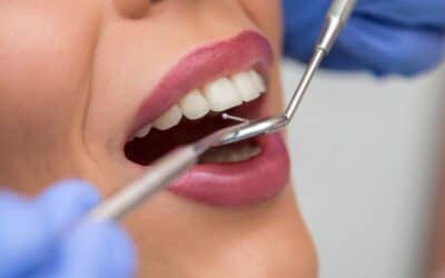 Thankful Teeth: Maintaining Oral Health on Thanksgiving