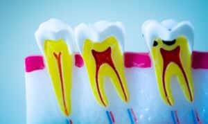 Dentist Stillwater OK