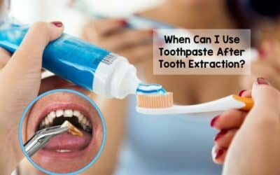 When Can I Use Toothpaste After Tooth Extraction?