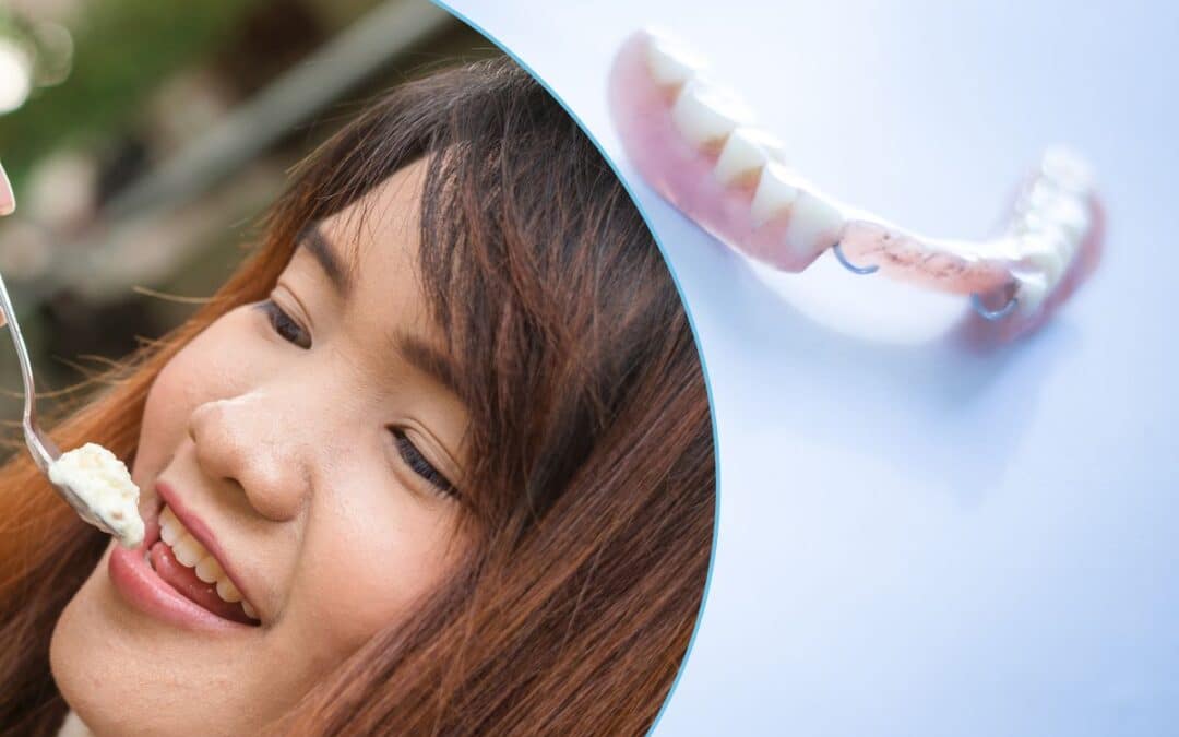 How Do You Eat With Upper Partial Dentures