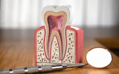 8 Common Signs You Need a Root Canal