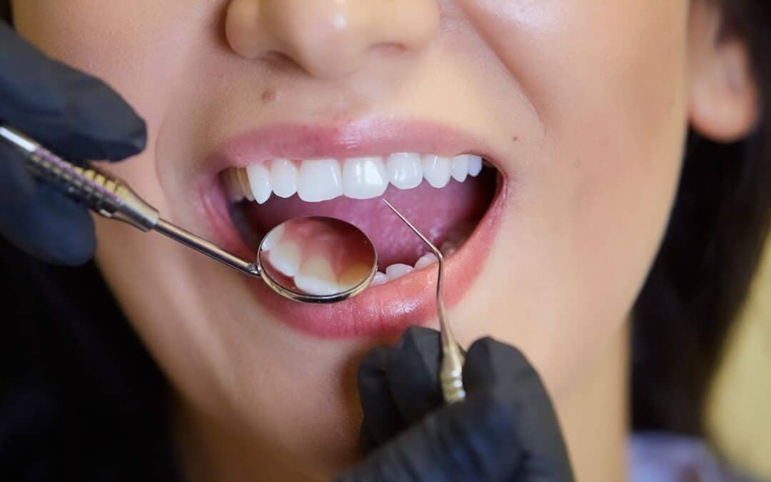 Cosmetic Dentistry Stillwater
