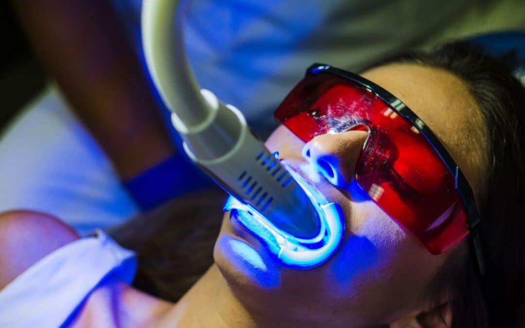 Teeth Whitening for Sensitive Teeth: What You Need to Know