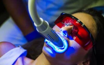 Teeth Whitening for Sensitive Teeth: What You Need to Know