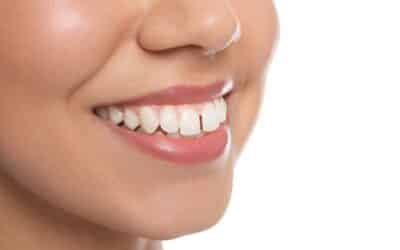 Is Your Teeth Gap Growing? Signs You Shouldn’t Ignore