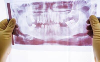 5 Common Dental Problems Dentists Deal With Every Day