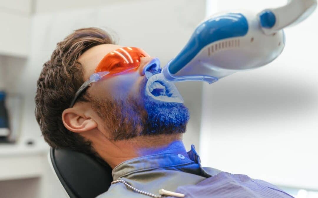 Can Teeth Whitening Damage Enamel