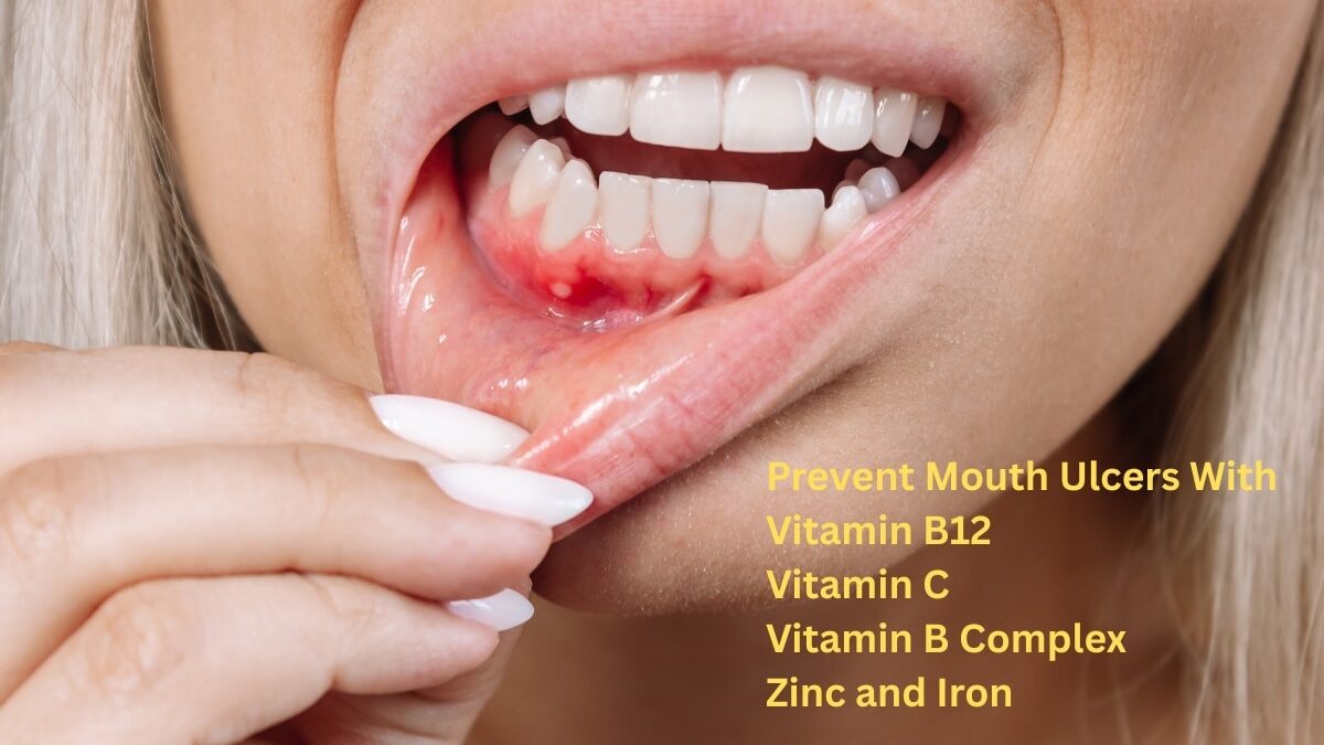 can you use vitamin c on lips Freshiny Vitamin C Lip Serum for Dry Lips, Crack Lips and Dark Lips!,  #freshiny #freshinylipglowserum #lipserum #lipgloss #liptherapy | Kristine  Figueroa Lugmoc main image 1