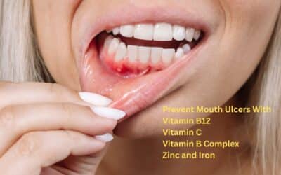 How to Prevent Mouth Ulcers With the Right Vitamins