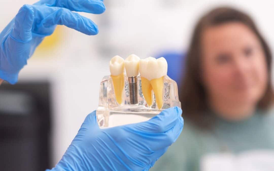 Dentures or Dental Implants: Which Option Fits You Best?