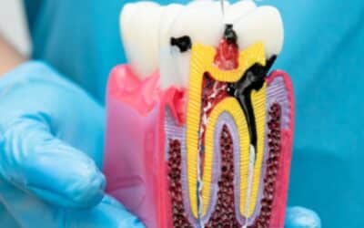 Root Canal for Front Teeth vs Molars: What’s the Difference?