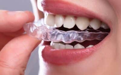 Smart Ways to Prevent Stains During Invisalign Treatment