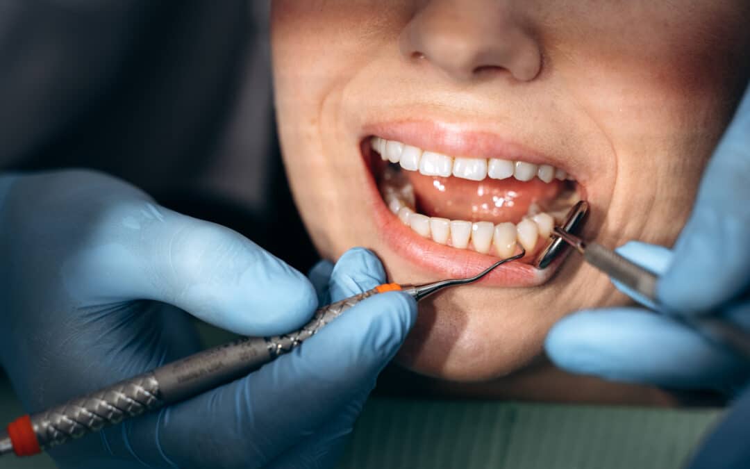 Dentist using ultrasonic scaler to clean patient's teeth during professional dental cleaning.