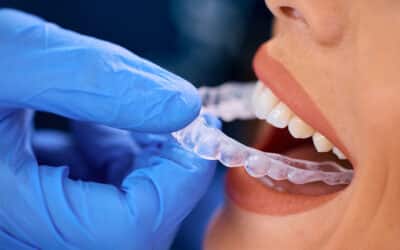 Is Invisalign Really Worth It? What Nobody Tells You